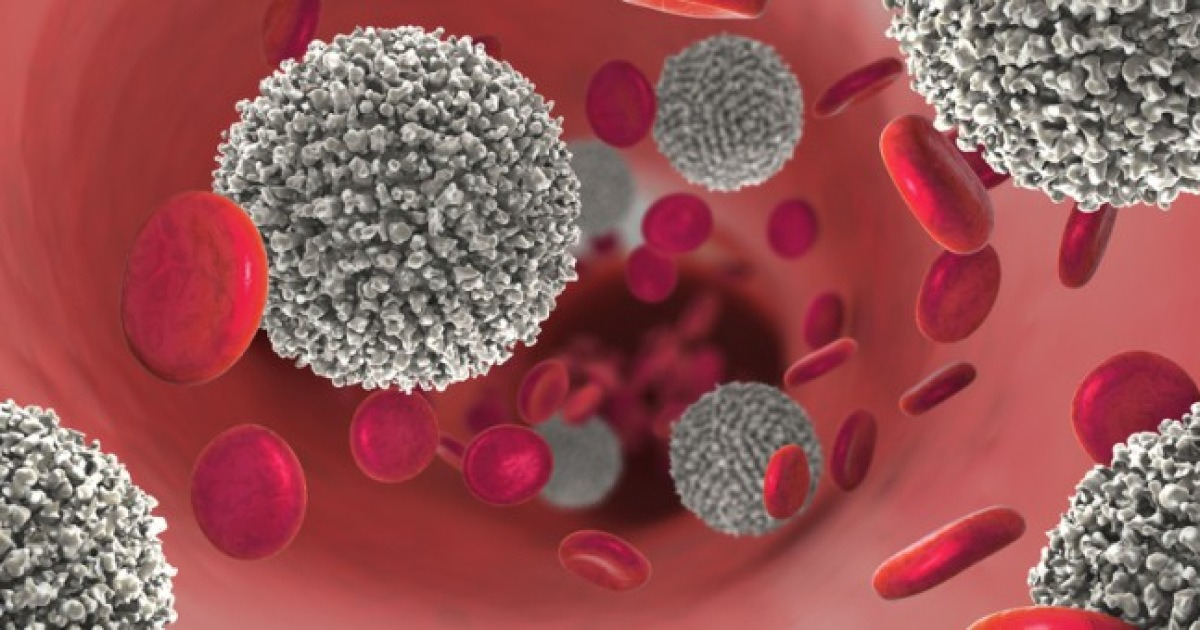 AI로 백혈병 치료 표적 정밀 예측…양자기술 접목도 추진