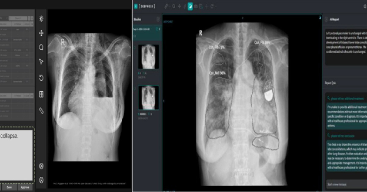 생성형 AI 기반 디지털의료기기 관련 이미지