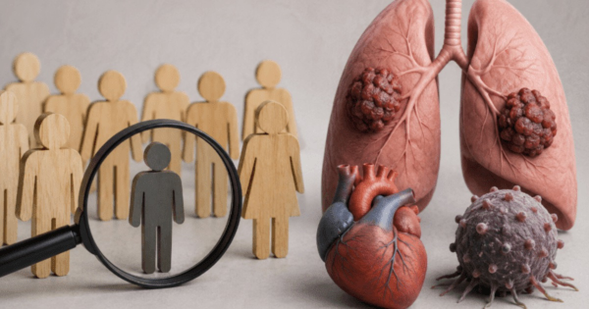 Cancer Leading Cause of Death in South Korea, Followed by Circulatory Diseases