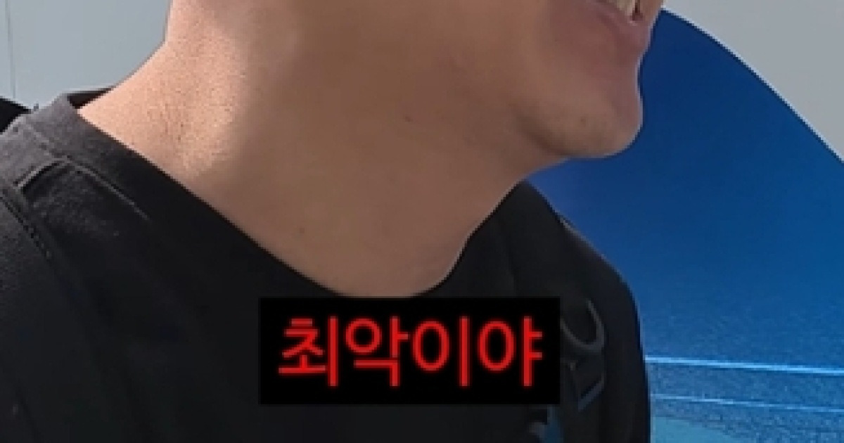 게장