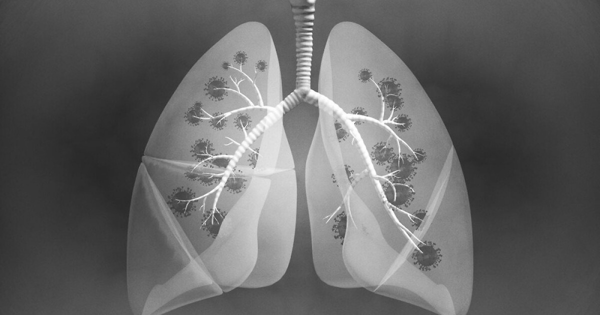 Family History Identified as Key Risk Factor in Non-Smoking Korean Women with Lung Cancer