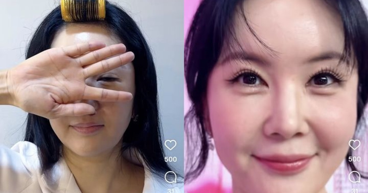 장영란, 4번째 눈성형 후 물오른 미모 "써클렌즈 뺐다"