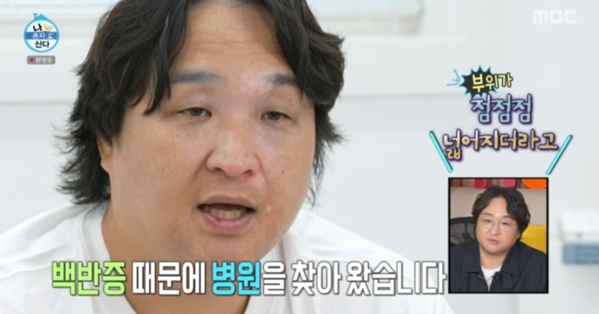 구성환, 심각한 피부 상태 “백반증, 점점 더 넓어져..눈썹도 탈색” (‘나혼산’)