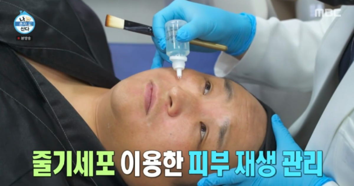 백반증 뭐길래..구성환, 눈→입 주변 하얗게 변해 “난치성에 스트레스多” (‘나혼산’)