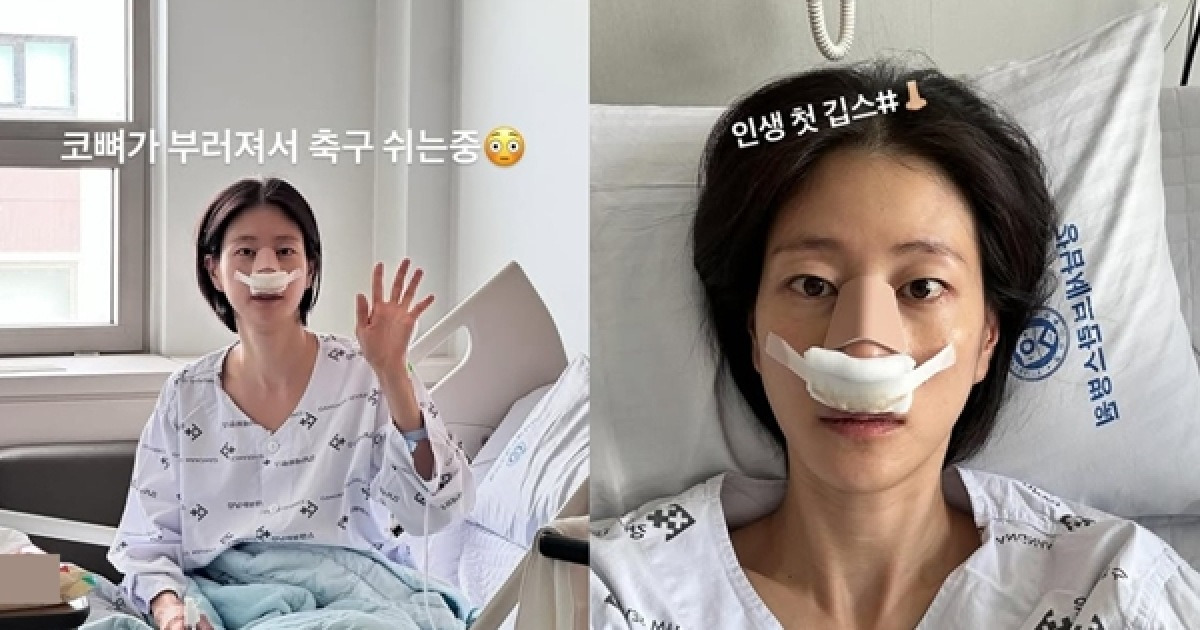 '골때녀' 이현이, 축구 중 코뼈 골절 부상 "지금은 잘 회복"