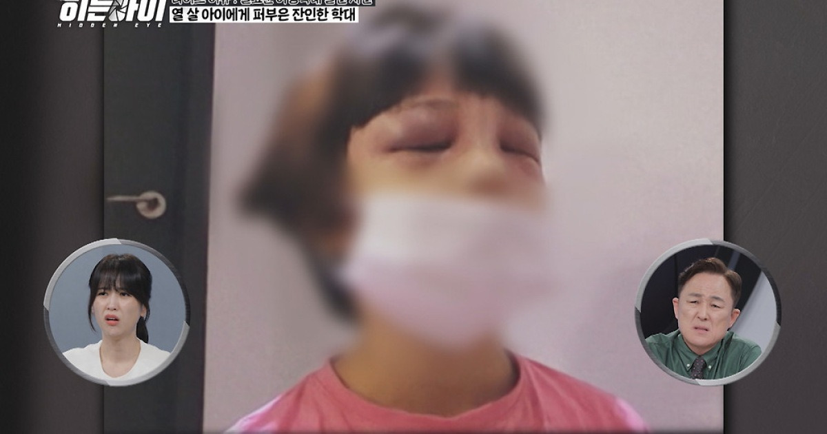 영상으로 드러난 아동학대의 민낯...김성주 "이건 친모도 공범"(히든아이)