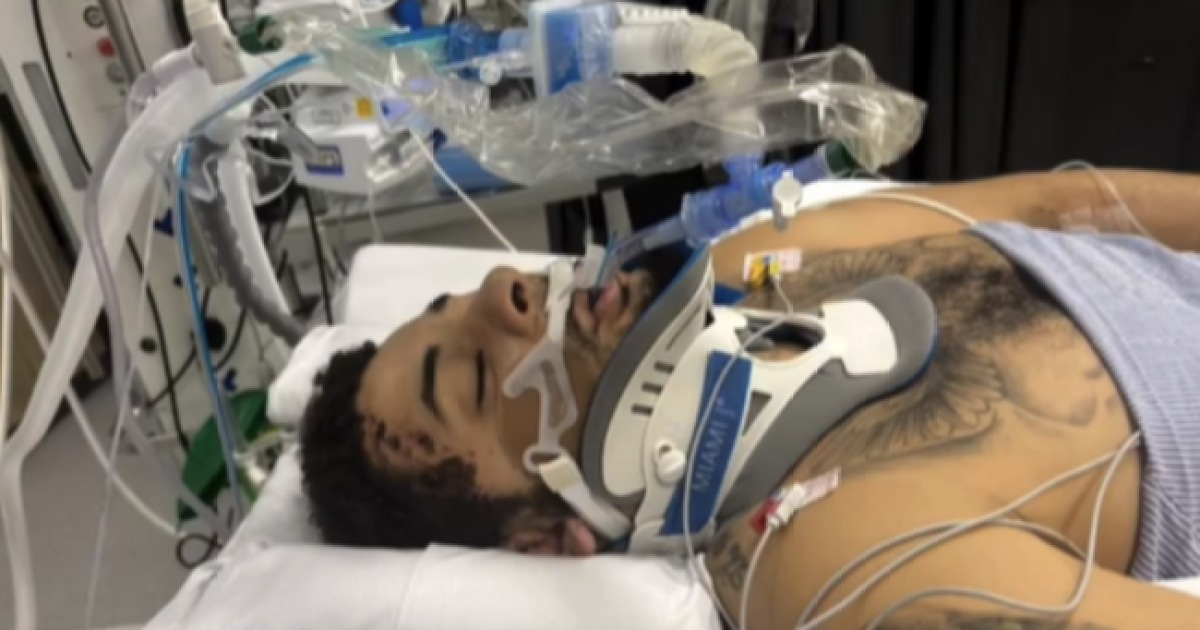 이렇게 억울하고 잔인한 인생 또 있을까? 음주운전 차에 치여 다리 잃은 축구선수