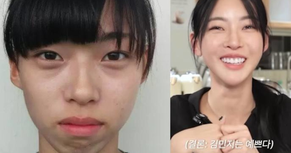 김민지 과거사진 관련 보도 이미지