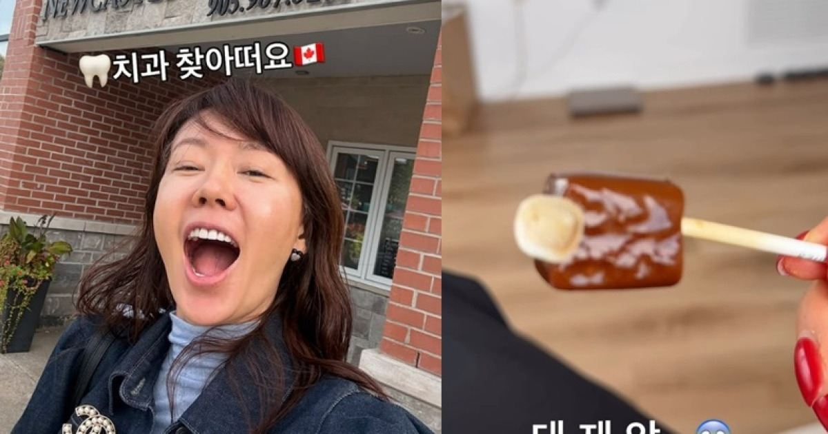 안선영