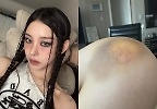 노제, 무릎에 \'심각한 피멍\' 공개..\'스월파\' 후유증 크다