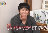 기안84, 라미네이트 고백…"전현무와 앞니 똑같아" 
