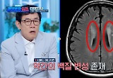 이경규, 뇌 건강 '빨간 불'… "백질 변성 존재, 치매 원인인 당뇨 연관" 