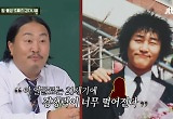“경쟁력 떨어져서” 조째즈, 눈→입 성형 1세대 고백 