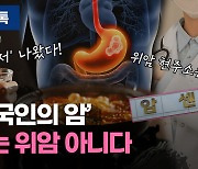 [리빙톡] '한국인의 암' 더는 위암 아냐..생존율 80% 육박