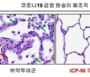 셀리버리 "코로나19 치료제 영장류시험 최종보고서 수령"