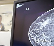 진행성 유방암, 수술 후 즉시 유방 재건해도 '안전'