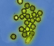 '스페인 독감'의 유산, '독감·폐렴' 중복감염 마침내 풀렸다