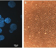 사람 섬유아세포 생산 기간·비용 확 줄인 3차원 배양기술 개발