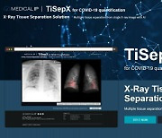 메디컬아이피, X레이로 폐렴 진단 AI '티셉' 세계 무료 공개