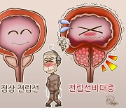 중년·노년 남성 밤잠 설치는 전립선비대증