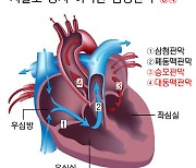 고장난 심장 승모·대동맥판막 동시 시술 국내 첫 성공