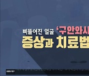 [1분 닥터] 비뚤어진 얼굴 '구안와사'..증상과 치료법은?