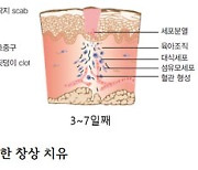 어제 실밥 풀었는데 상처가 벌어졌어요.. 이유가 뭐죠? [의사에게 듣는 '질환' 이야기]