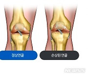 새해 절주·금연·다이어트가 관절 건강도 지켜준다