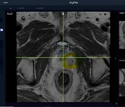 뷰노, 전립선 자기공명 영상 분석 소프트웨어 식약처 인증