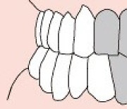 코로나19 시대에는 임플란트도 비대면?