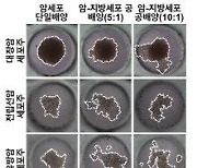 "비만이 암을 악화" 지방세포 지방산이 암세포 전이 일으킨다