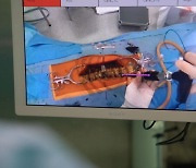 분당서울대병원, AR 기술 적용한 척추수술 플랫폼 개발