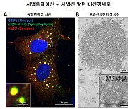 腦 속 신경전달물질 유동성(流動性) 원리 풀렸다