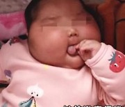 유아용 크림 바른 5개월 아기, 얼굴 부풀어 오르는 부작용 '심각'