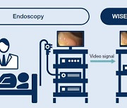 NEC Releases "WISE VISION Endoscopy" in Europe and Japan