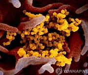 러시아서 코로나19 감염자 1명에게서 18종의 변이 바이러스 발견
