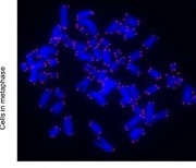코로나 감염 시 폐세포 텔로미어 준다..'후유증으로 폐섬유증'