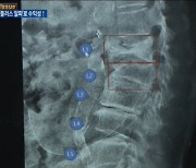 의료AI 업계, 올해는 차별화 '열전'