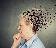 시냅스 단백질 이상증가 막으면 알츠하이머 치매 피할 수 있다
