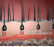 LG 프라엘 메디헤어 TV광고 '온에어'.."탈모치료, 이렇게 도와요"