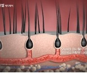 "탈모치료기 사용해 보세요"..LG전자, 프라엘 메디헤어 TV광고 시작