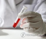 "코로나19 증상 악화 예측 혈액 검사법 개발"
