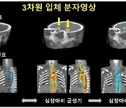 화내다 갑자기 가슴 움켜잡으며 '윽'..연결고리 규명