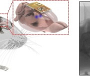 뇌에 심은 '무선충전 칩'.. 뇌 질환 밝히는 열쇠 될까