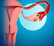 여성성의 상징 '난소'.. 35세부터 달라지는 것