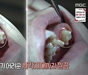 '생방송 오늘아침' 소개 구강관리 비결..구강세정기 '아쿠아픽' 관심