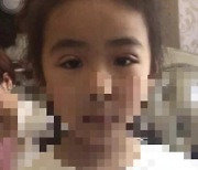 7살 딸에게 "쌍수하러 가자"..중국 휩쓰는 '성형 광풍' [조아라의 소프트차이나]
