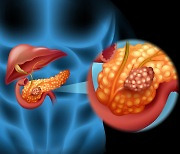 스티브 잡스도 피하지 못한 췌장암, 혈액검사만으로 조기 진단한다