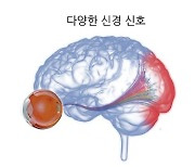 "시신경 세포 다양해야 더 잘 볼 수 있다"