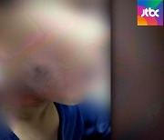 수면 위 드러난 '상처'..어린이집 학대 왜 반복되나?